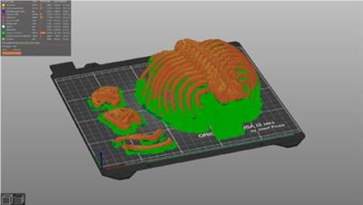 Inanimate 3D printed model for thoracoscopic repair of esophageal atresia with tracheoesophageal fistula